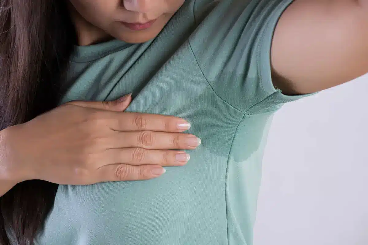 hyperhidrosis