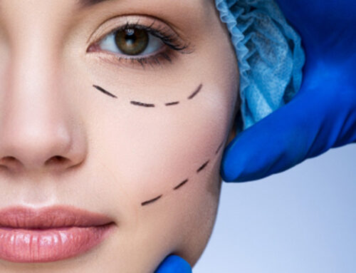 3+1 αλήθειες για την πλαστική χειρουργική