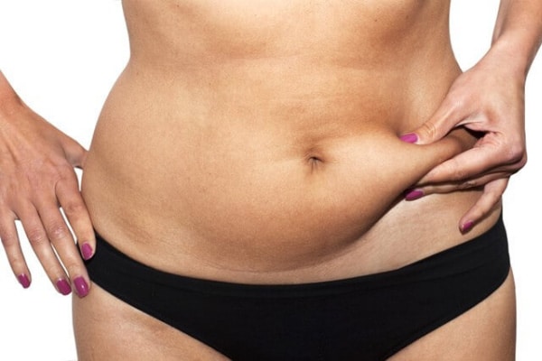 Λιποαναρρόφηση κοιλιάς:  Πώς γίνεται η επέμβαση. 