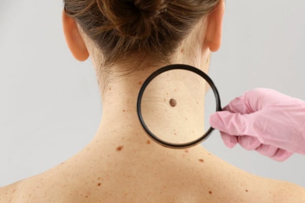 Τι είναι η Χαρτογράφηση Σπίλων και πότε πρέπει να την κάνω;