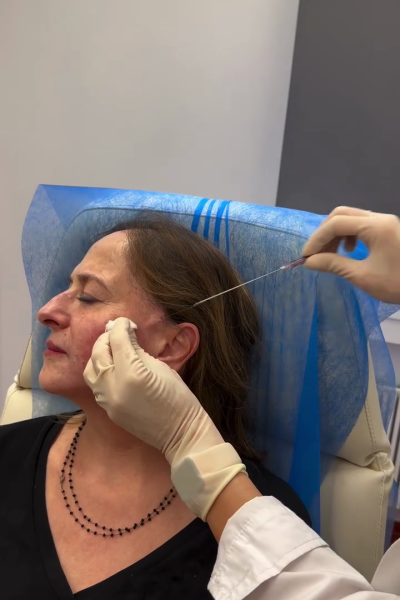 Margarita Moustaki_lifting με νήματα_application