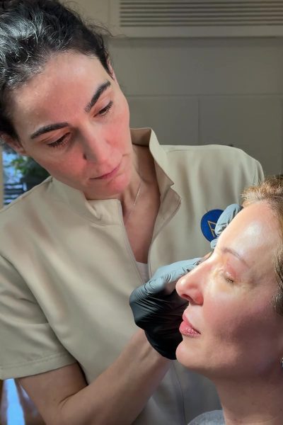 Margarita Moustaki_βλεφαροπλαστική_αφαίρεση ραμμάτων