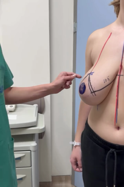 Margarita Moustaki_μειωτική στήθος_είναι κατάλληλη για εμένα