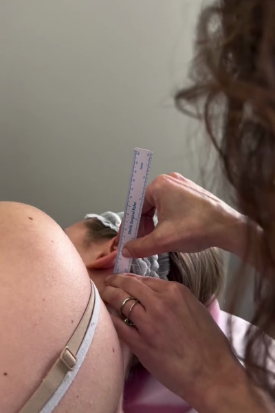 Margarita Moustaki_ωτοπλαστική_πότε δε συστήνεται